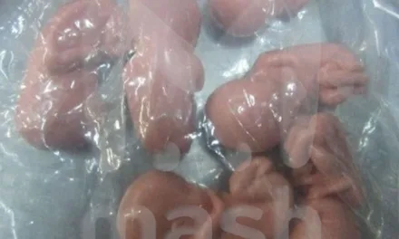 Сотни человеческих эмбрионов обнаружены в сумке