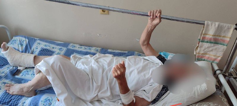 Жертва нападения солевого нудиста из Севастополя в тяжелом состоянии