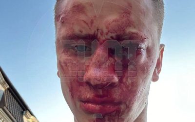 Чемпион России и Европы по боксу лишился глаза, защищая мальчика в Феодосии