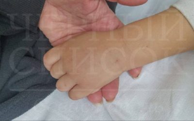Мучения ребенка в больнице: медсестры не могут поставить капельницу
