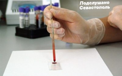 В Крыму за 9 месяцев выявлено 633 новых случая ВИЧ-инфекции